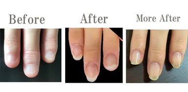 Before→After→More After