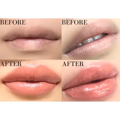 リップアートメイクの施術経過(2)