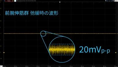 MyoScan計測データ
