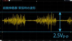 MyoScan計測データ