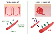 図3　毛細血管拡張のメカニズム