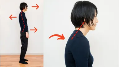 現代人に多く見られる猫背＆ストレートネック