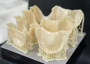 3Dプリンターによる複製義歯