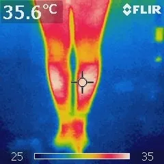 電気を使わず温熱効果があるタオルケット(一般医療機器)「メディカル 