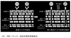 4-TENS図
