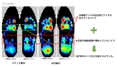 足圧が変化し前すべりが軽減し安定します