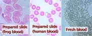 血液細胞実例