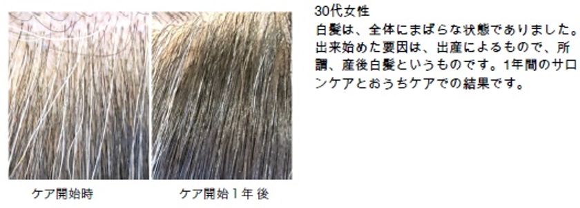 コロナ禍の京都で2o代女性の約2割に白髪が増加 中京区の美容院が白髪対策の U29割 で緊急支援を開始 アムズ株式会社のプレスリリース