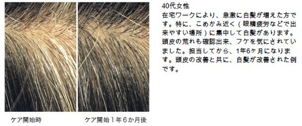 コロナ禍の京都で2o代女性の約2割に白髪が増加 中京区の美容院が白髪対策の U29割 で緊急支援を開始 アムズ株式会社のプレスリリース