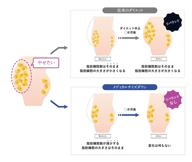 リバウンドの仕組み