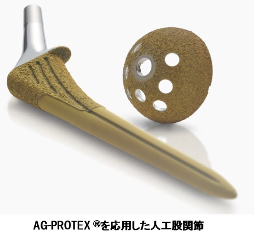 佐賀大学、京セラが令和3年度全国発明表彰
「日本弁理士会会長賞」を受賞