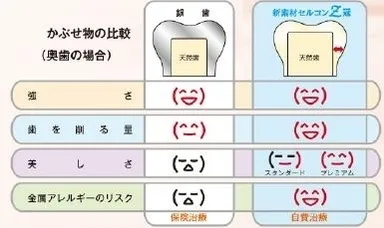 セルコンZ冠 銀歯との比較