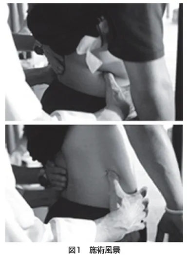 図1　施術風景