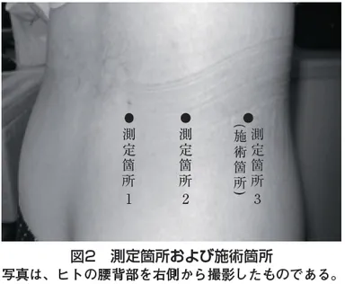 図2　測定箇所と施術箇所