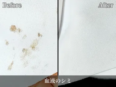 血液のしみ抜きビフォーアフター