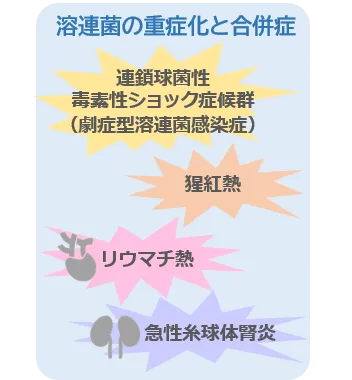 溶連菌の重症化と合併症