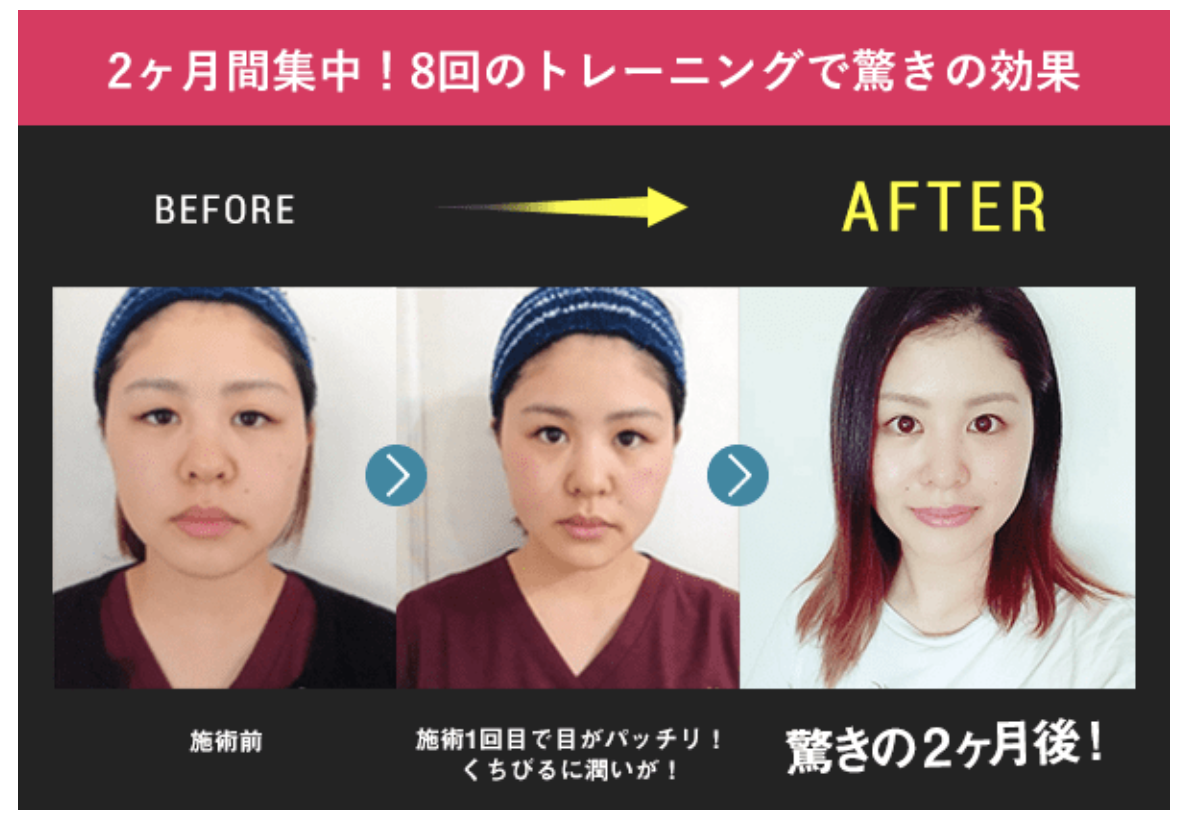 日本初 顔専門ジム 顔ジム R がボランタリーチェーンの募集をスタート 株式会社 Pranaのプレスリリース 日本初 顔専門ジム 顔ジム R がボランタリーチェーンの募集をスタート 株式会社 Pranaのプレスリリース