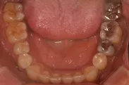 理想的な歯並び
