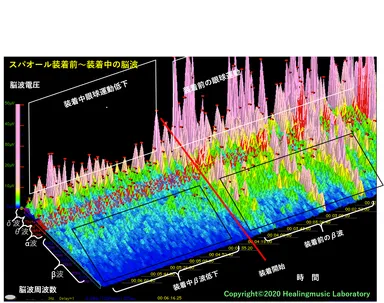 スパオール製品装着前後の脳波の状態