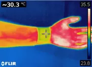 図1. メラミンスポンジの断熱効果で人体表面と熱電発電機の外気と接する面との間に大きな温度差(外気温23.8℃、熱発電機外部温度30.3度、皮膚温度35.5℃)を実現