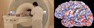 図3：NICT CiNetで導入しているMRI装置(左)とスキャンした結果から推定した脳の活動状態(右)