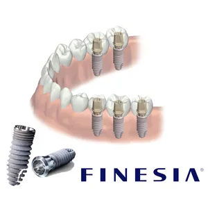 京セラ ファインシア　インプラント