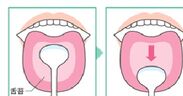 舌ブラシによる舌苔除去の方法