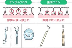 歯間清掃用具の種類と使い分け
