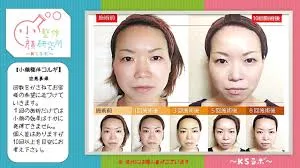 ビフォーアフター