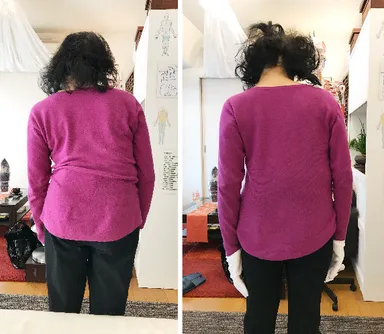 左から施術前と施術後腰に痛みを抱えていた