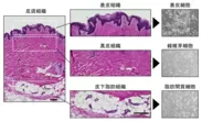 図1　1人のドナーの皮膚組織から3種類の皮膚細胞を分離