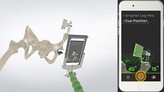 「AR Hip Navigationシステム(ポータブルナビゲーション)」