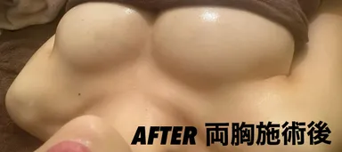 バストアップ技術(2)