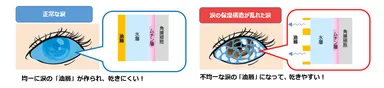 図1　「正常な目」と「油層の不安定化によりドライアイ(目の乾き)になっている目」(イメージ図)