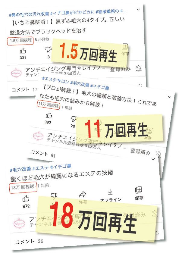 美容/健康 美容機器 黒ずみ角栓を除去してツルツル輝く鼻へ！肌に優しい家庭用毛穴ケア 