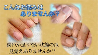 爪のお悩みを抱える人は多い