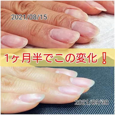 サロンスタッフの爪の変化