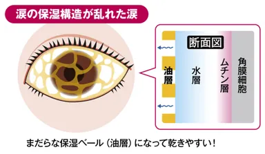 図8) 涙の保湿構造が乱れた涙