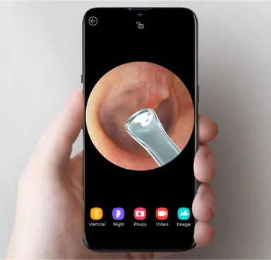 耳の中がはっきり見える