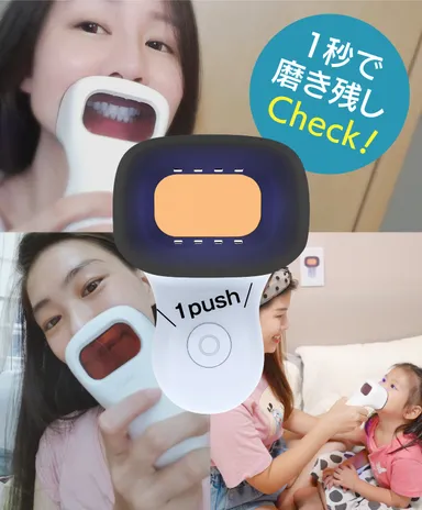 1秒で磨き残しCheck