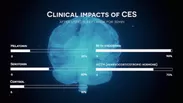 CES(Cranial Electrotherapy Stimulation)テクノロジー