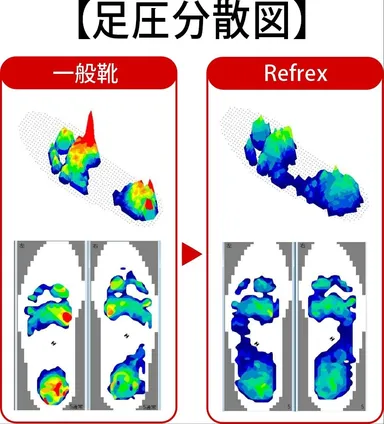 足圧分散図