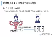 精子提供による治療の方法-人工授精(AID)