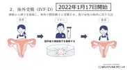 精子提供による治療の方法-体外受精(IVF-D)