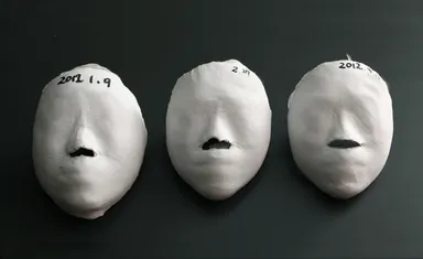 小顔施術結果写真