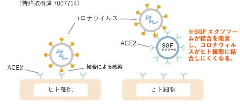 SGFによる新型コロナウイルスの感染予防キットの提供を開始