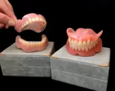 特許・治療用義歯とパリムデンチャー