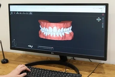 矯正シミュレーション