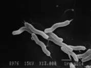 電子顕微鏡で見たピロリ菌(出典：東海大学医学部 古賀 泰裕客員教授)