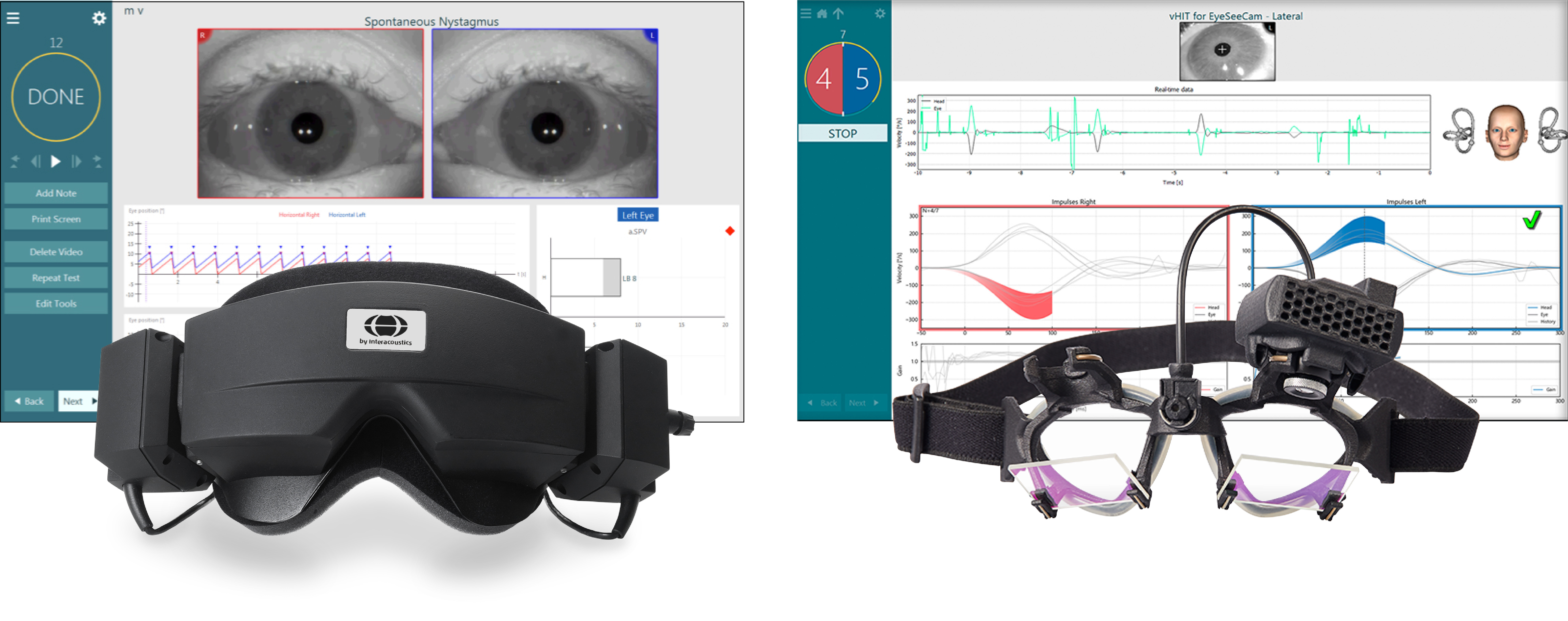 ダイアテックカンパニー、VNGおよびvHITを1台へ統合した、眼球運動検査装置「VisualEyes... 画像